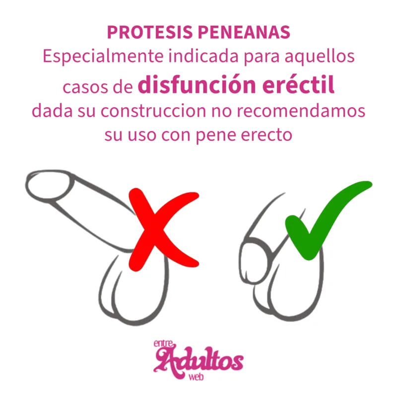 Protesis Peneana Semirigida Pellizcable Mod 3 (17x3cm)